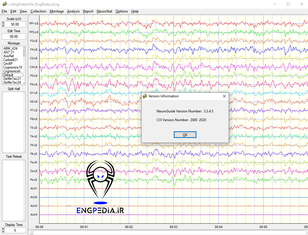 NeuroGuide