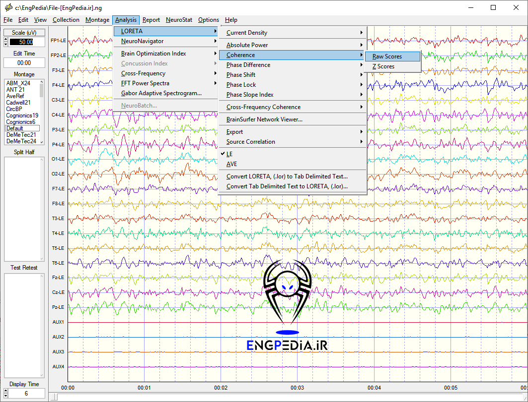 NeuroGuide