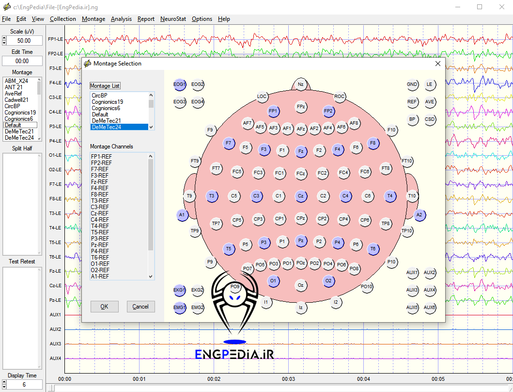 NeuroGuide