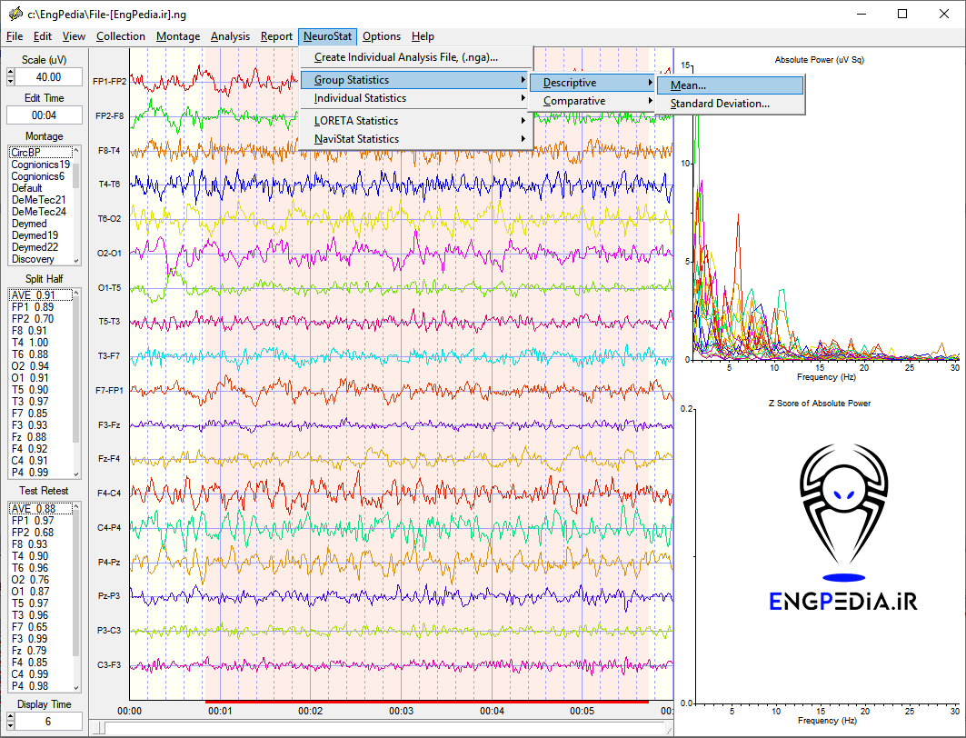 NeuroGuide