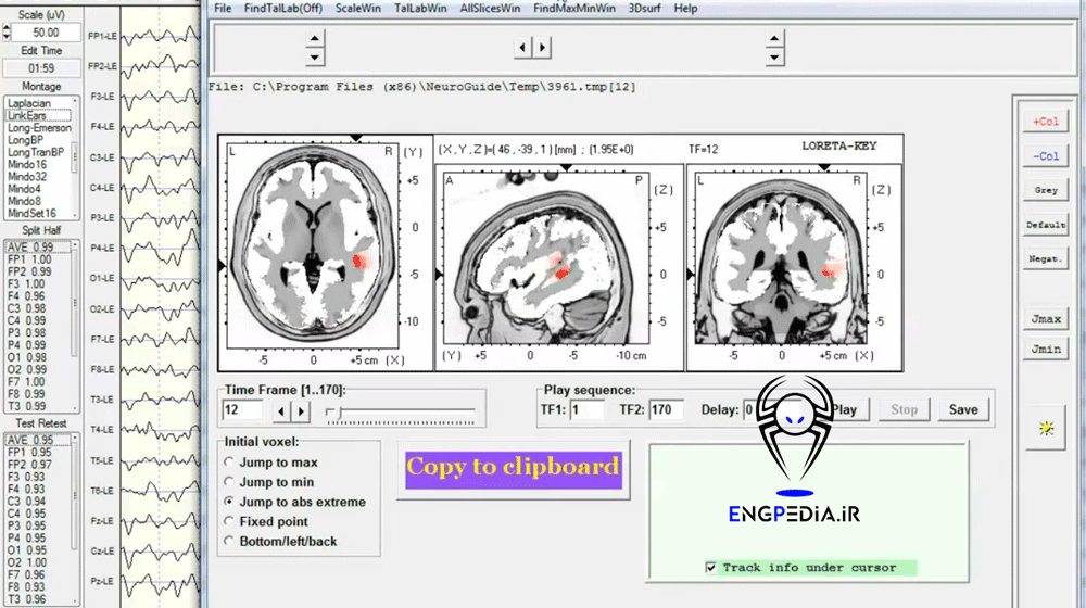 NeuroGuide