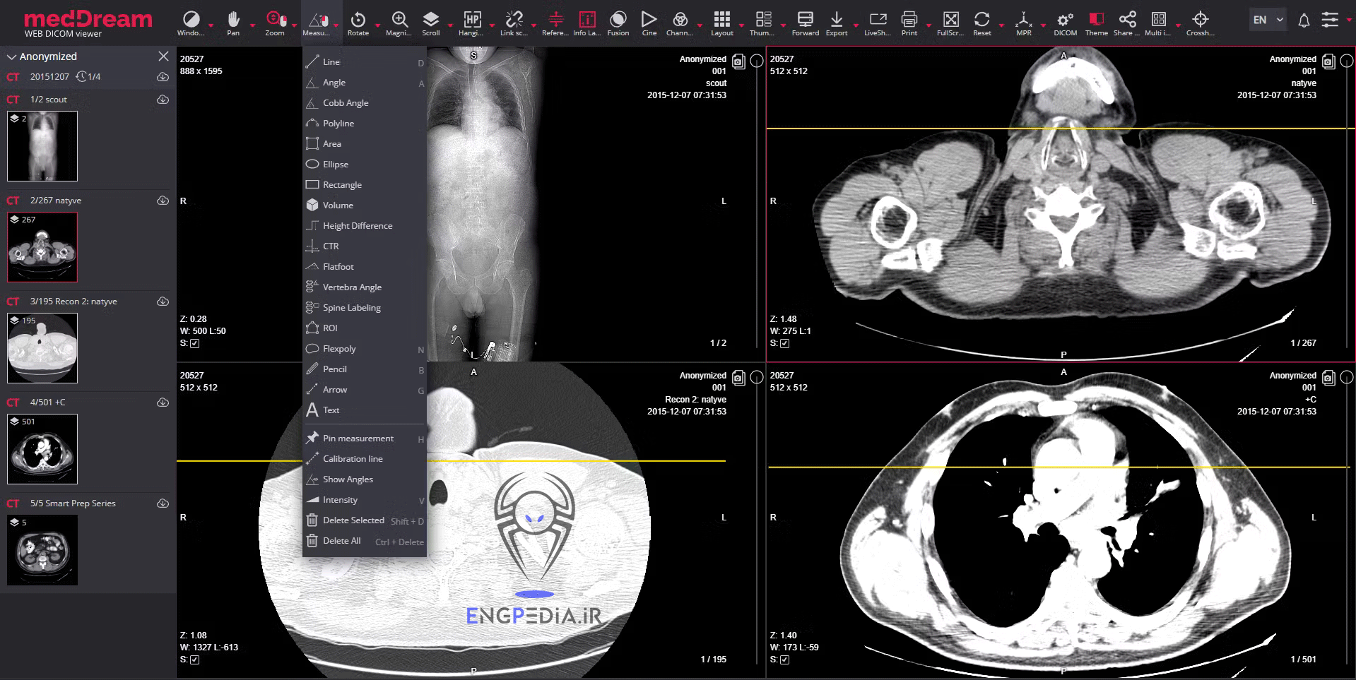 MedDream DICOM Viewer