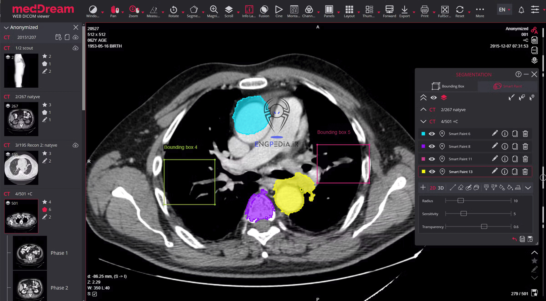 MedDream DICOM Viewer