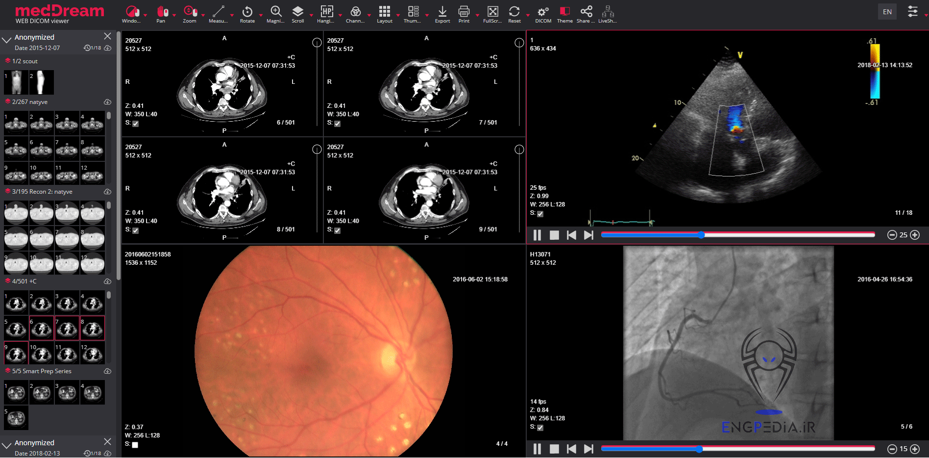 MedDream DICOM Viewer