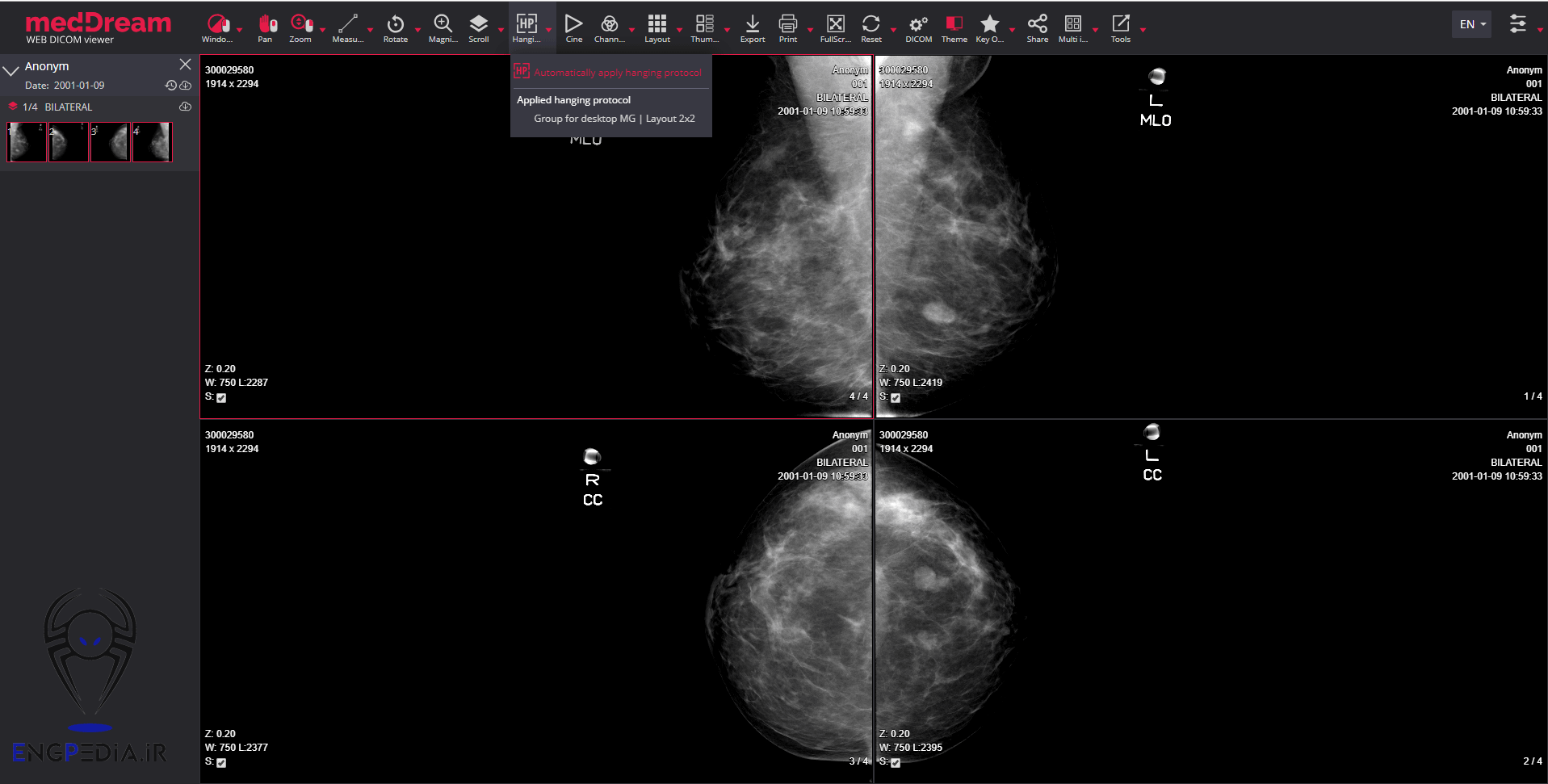 MedDream DICOM Viewer