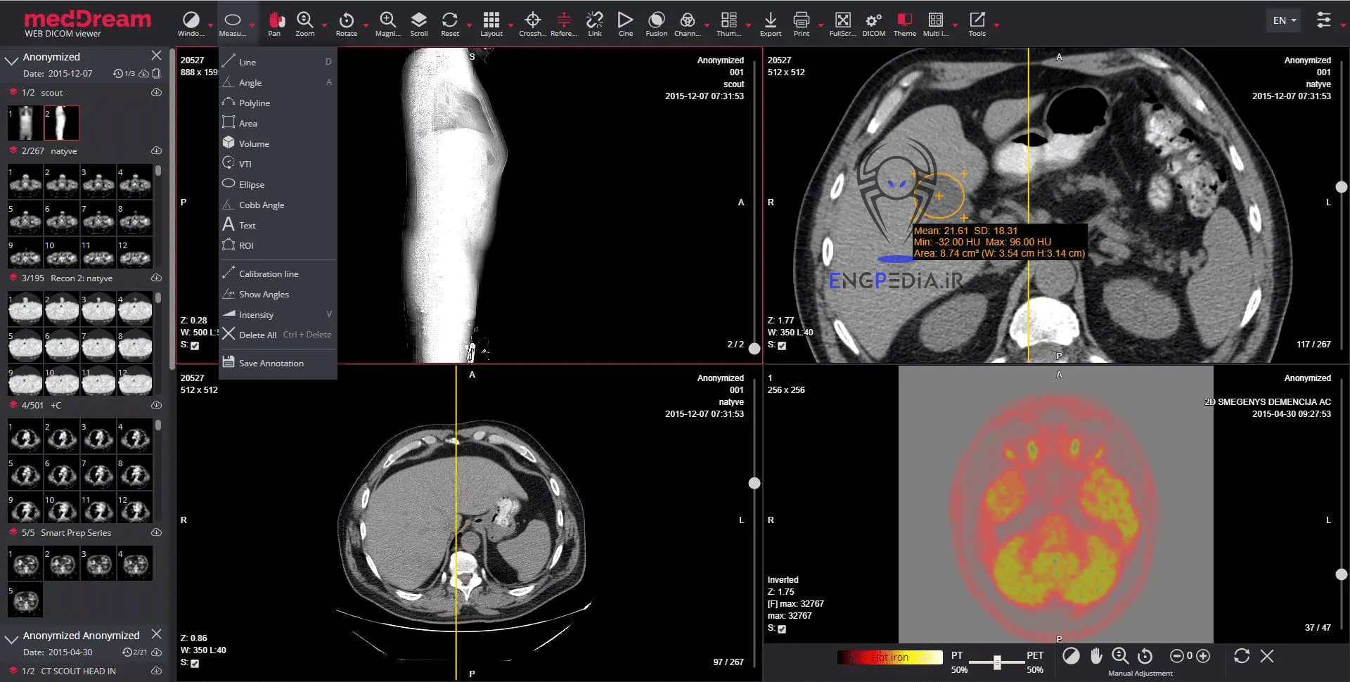 MedDream DICOM Viewer