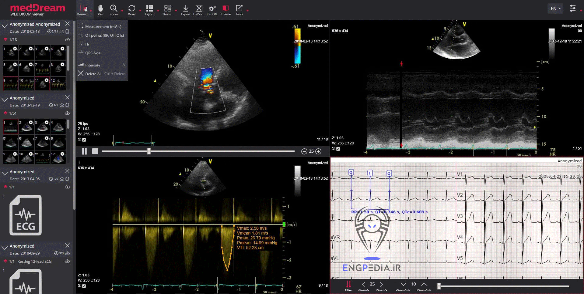 MedDream DICOM Viewer