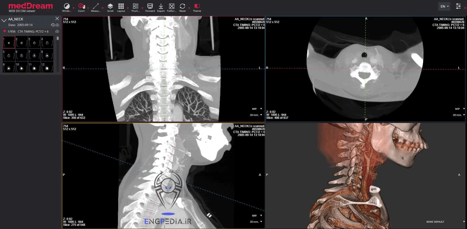 MedDream DICOM Viewer
