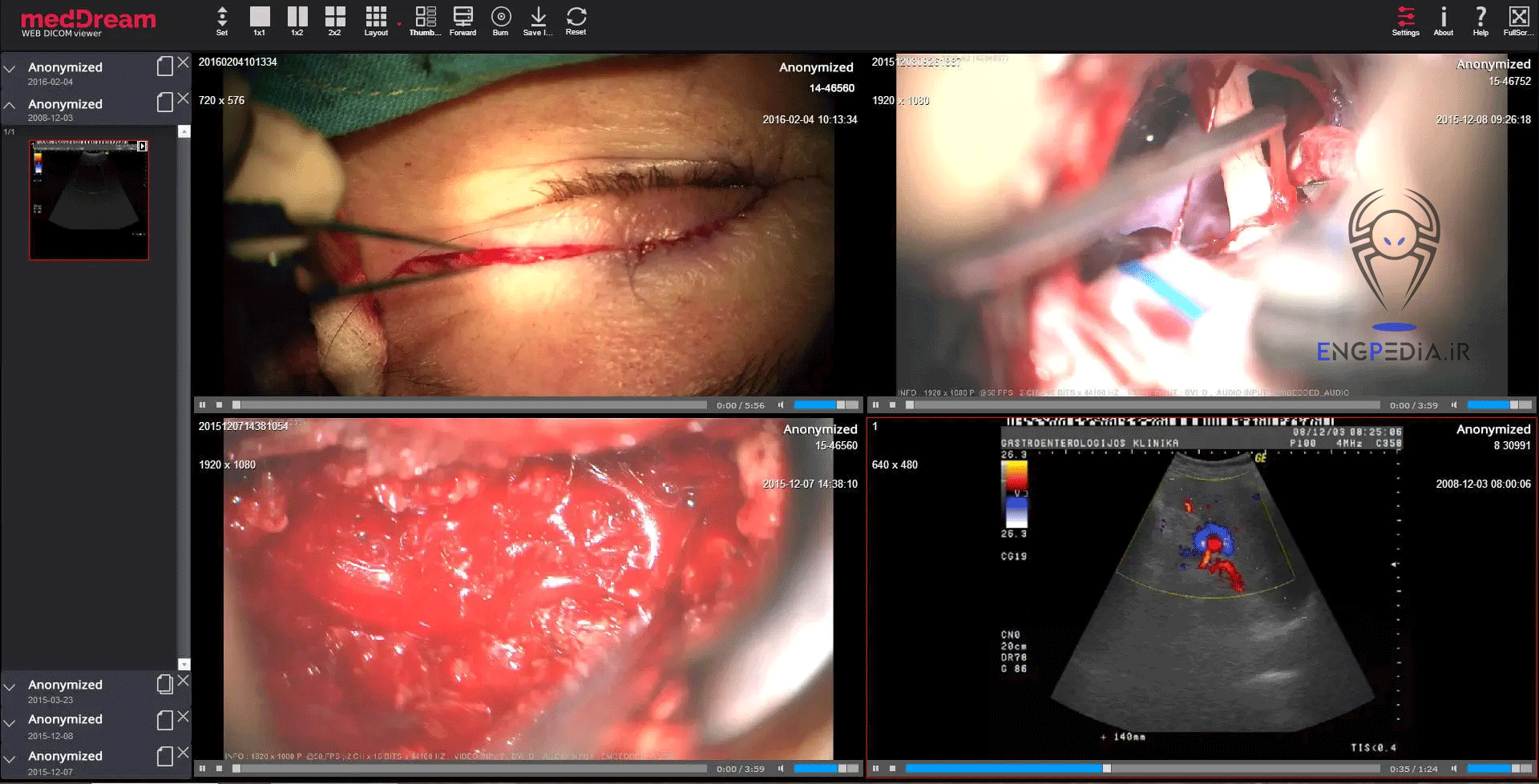 MedDream DICOM Viewer