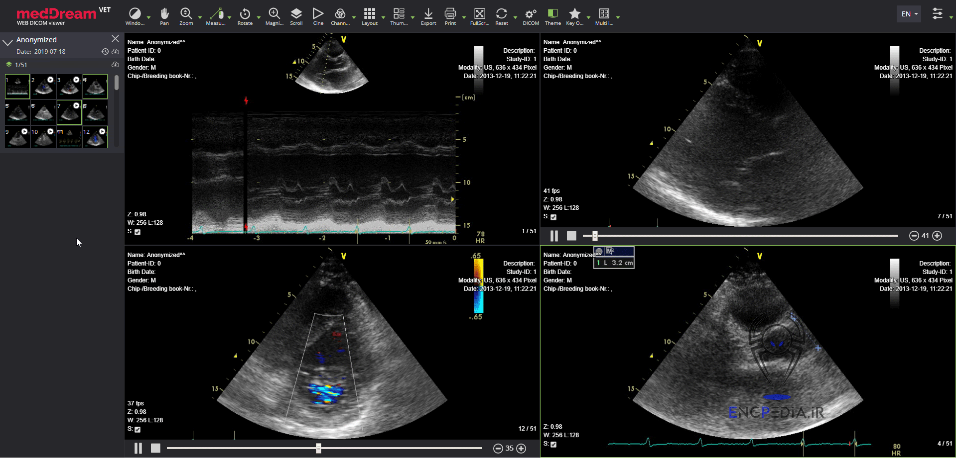 MedDream DICOM Viewer
