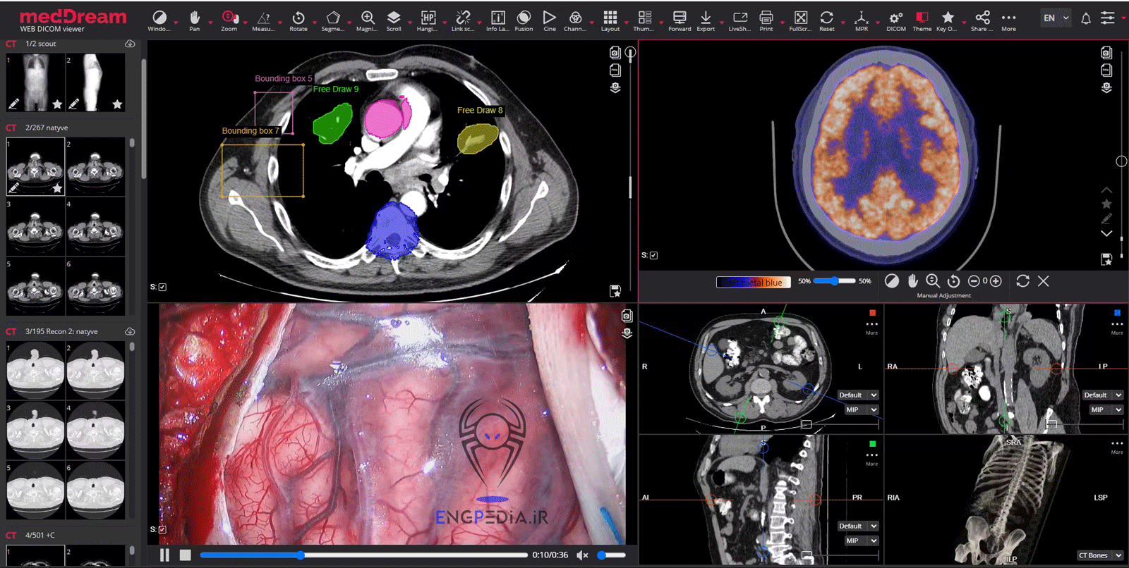 MedDream DICOM Viewer