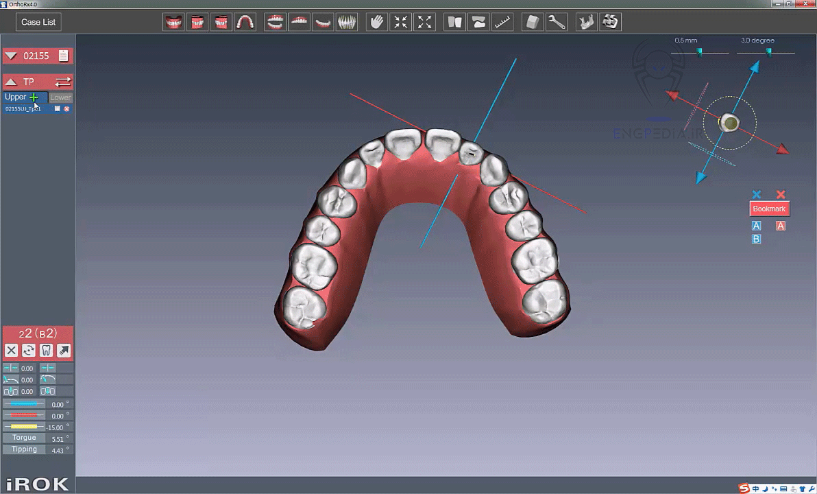 iROK Digital Dentistry Studio