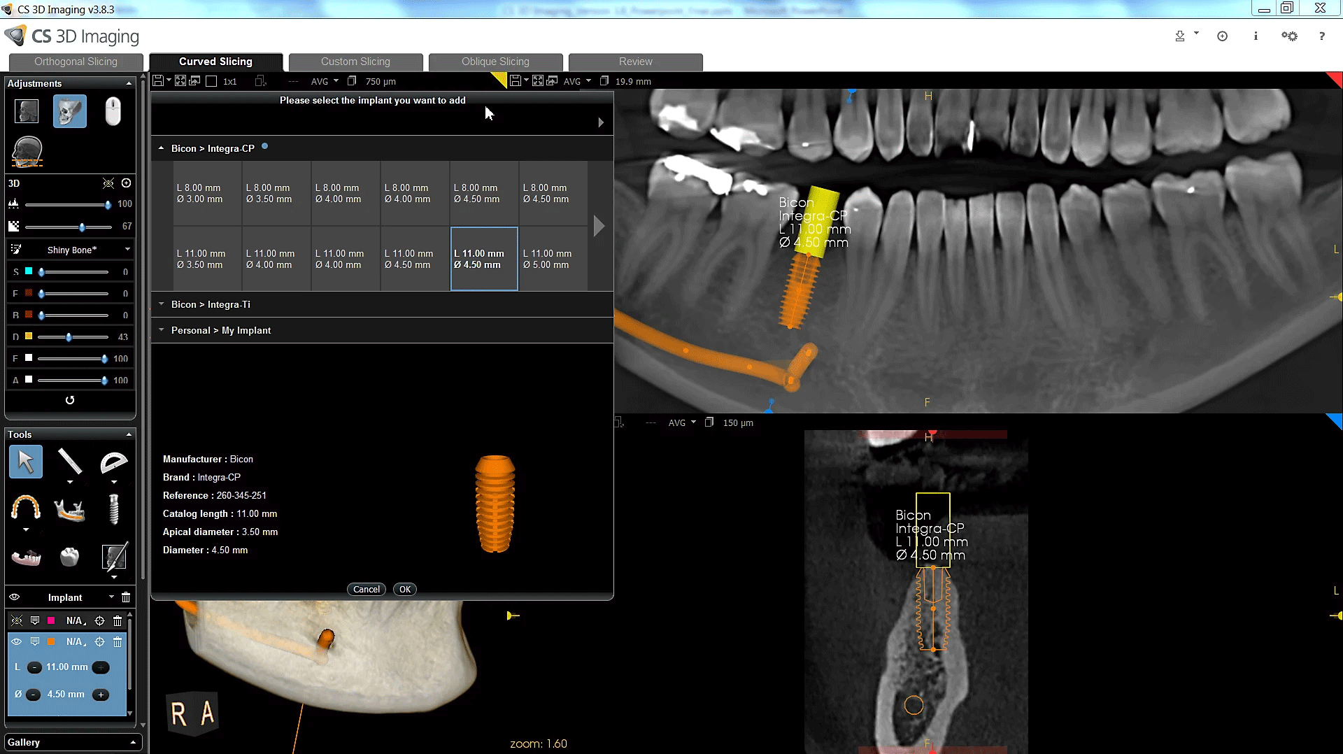 CS 3D Imaging