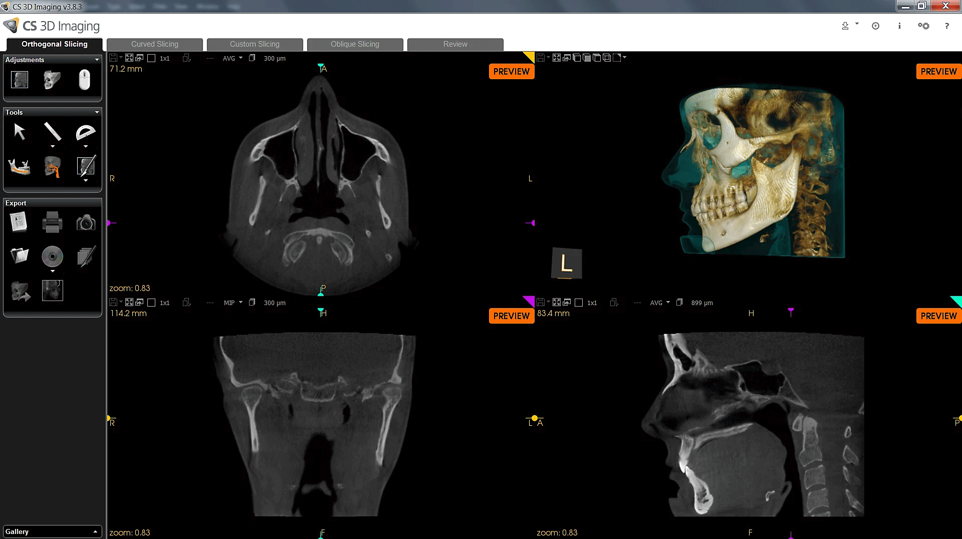 CS 3D Imaging