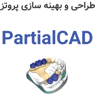 PartialCAD 3.3 طراحی و بهینه سازی پروتز