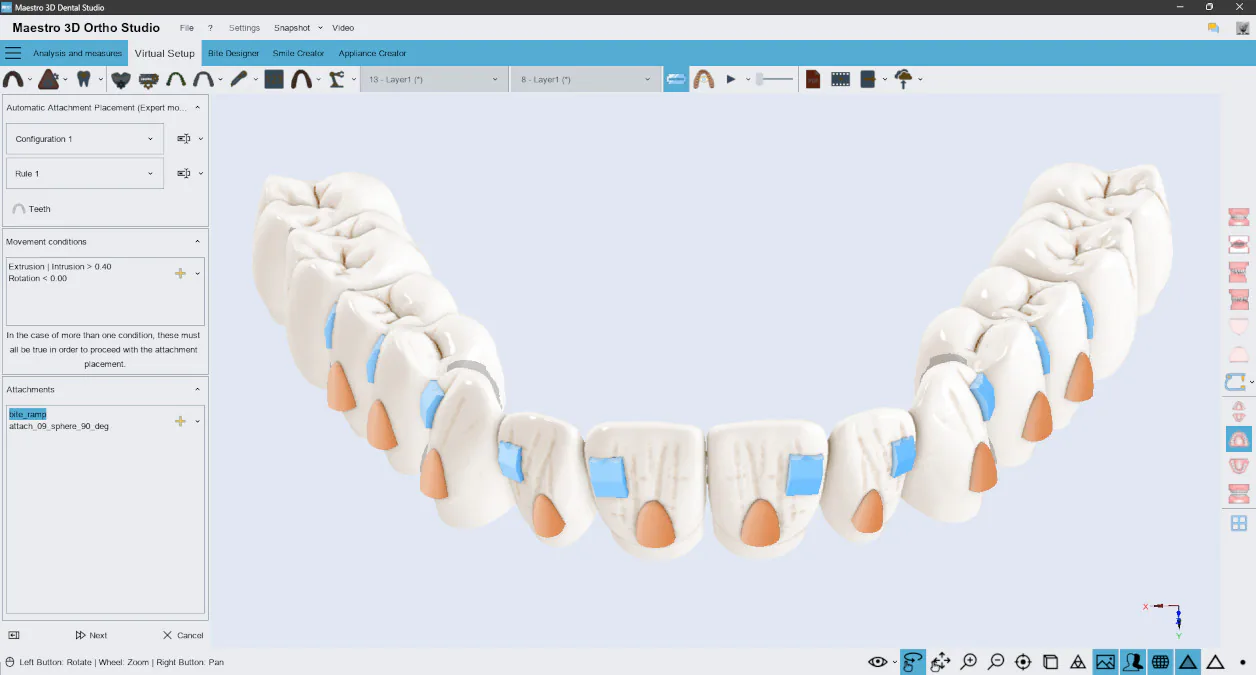 Maestro 3D Dental Studio
