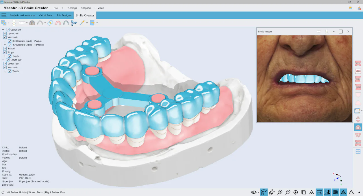 Maestro 3D Dental Studio