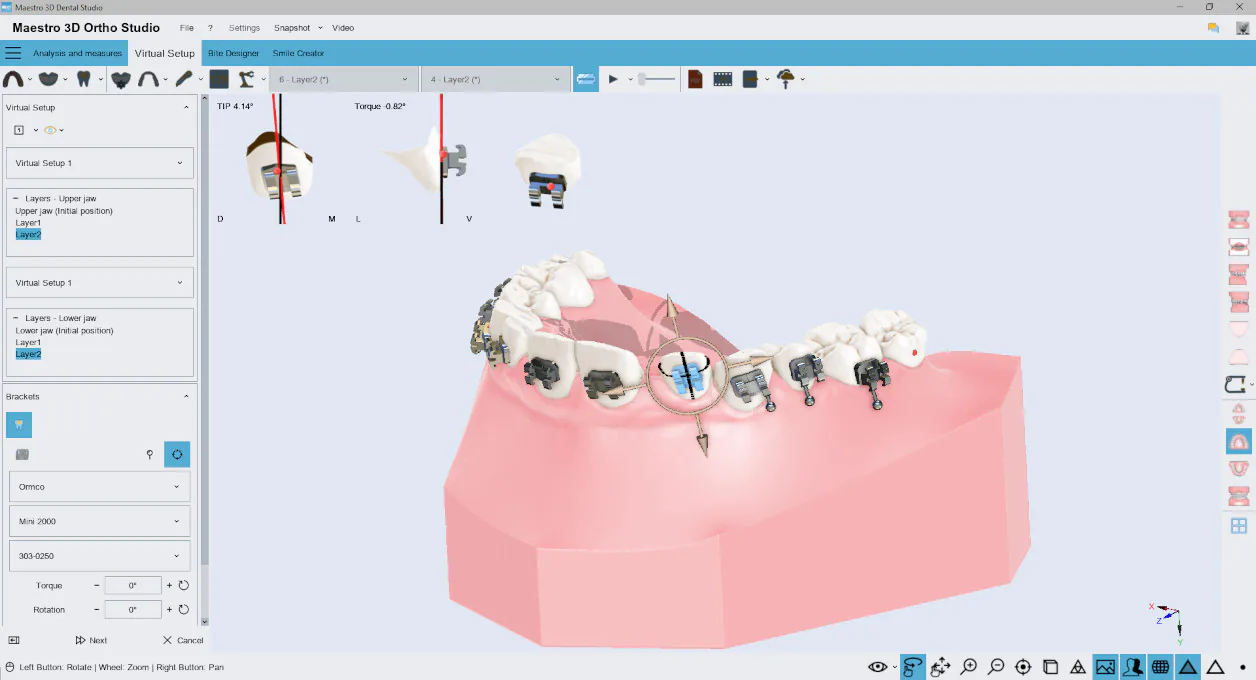 Maestro 3D Dental Studio