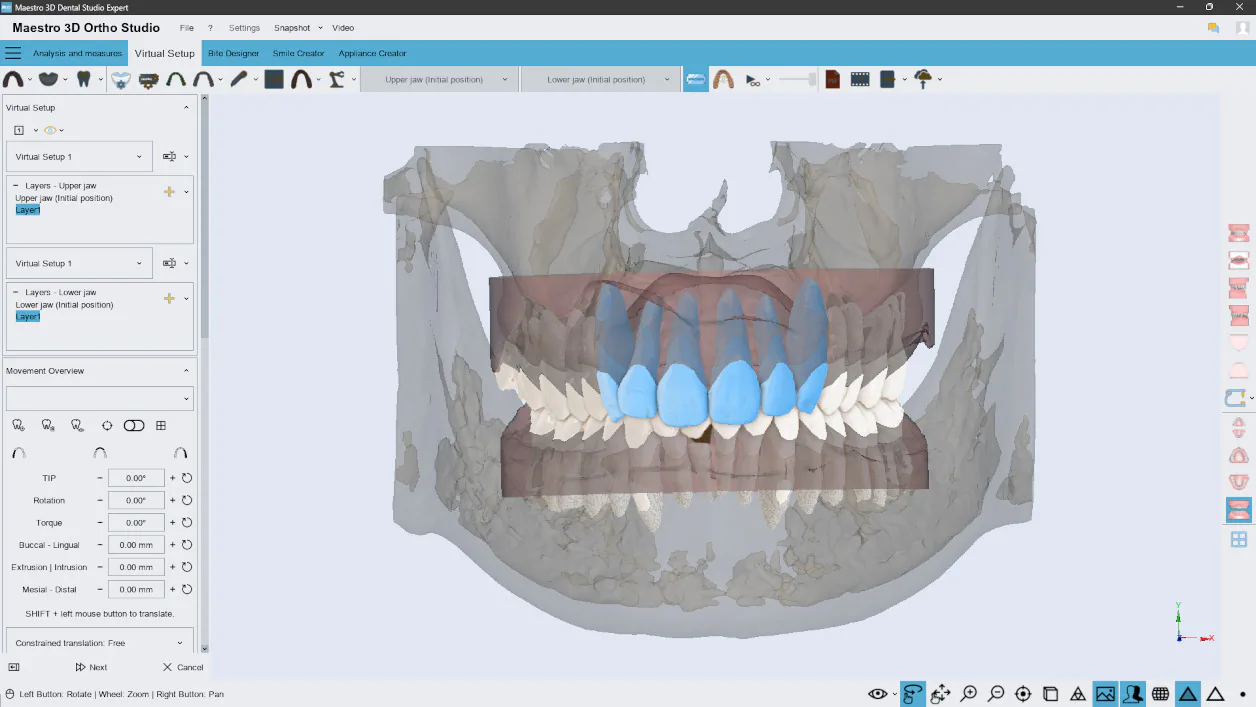 Maestro 3D Dental Studio